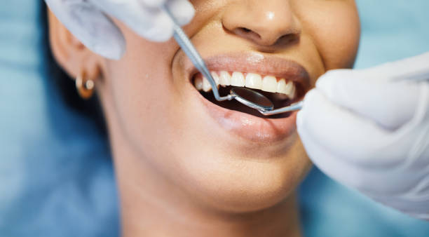 Best Emergency Dentist for Knocked-Out Tooth in Vla Grove, IL