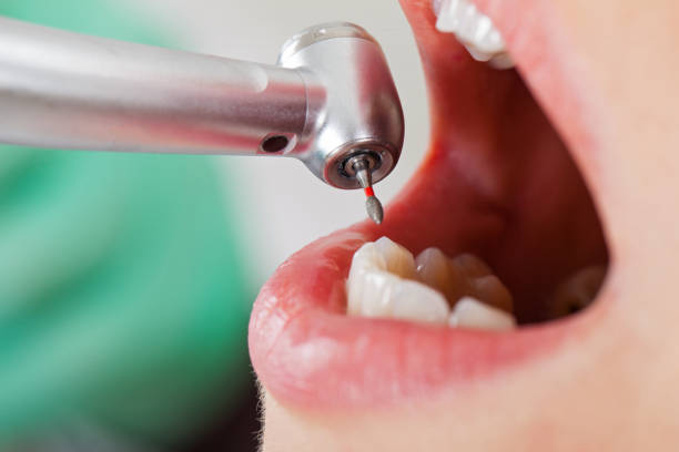 Best Emergency Dentist for Lost Fillings or Crowns in Vla Grove, IL